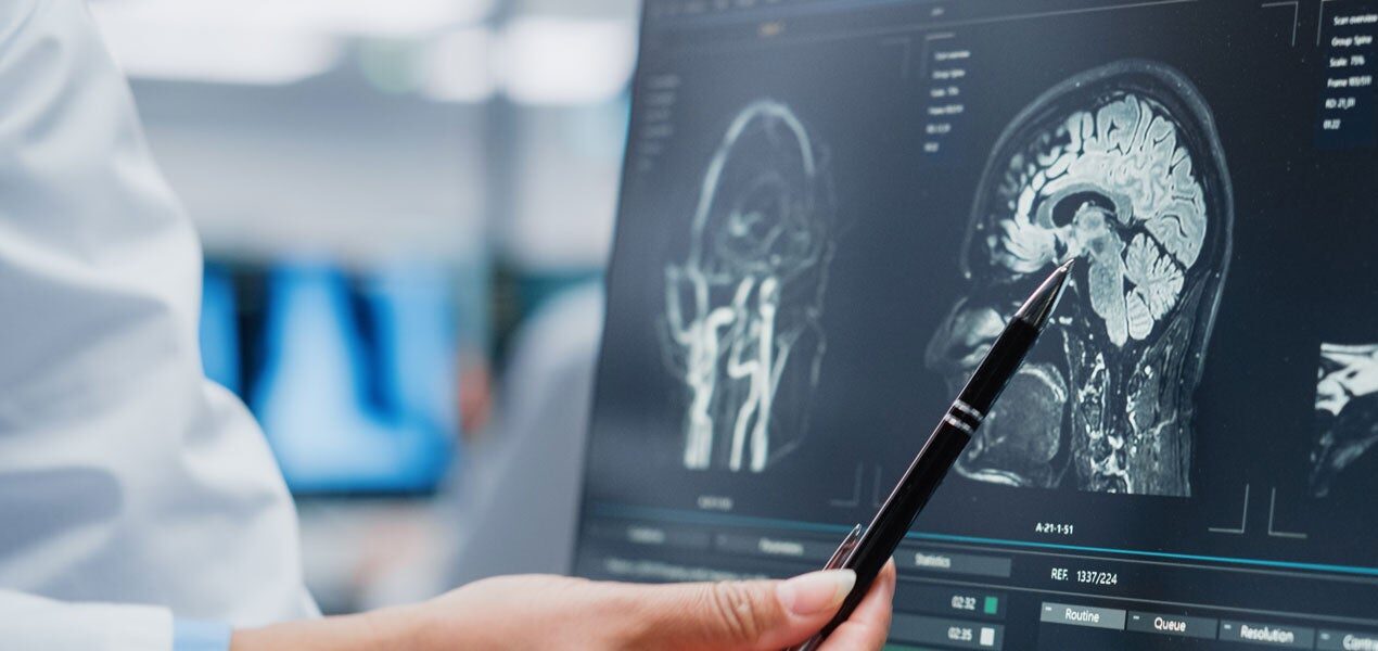 doctor examining a brain image